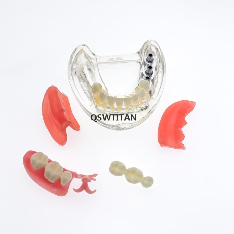 modelo didáctico implantes