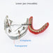 modelo prótesis dental