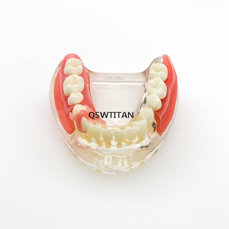 modelo didáctico implantes