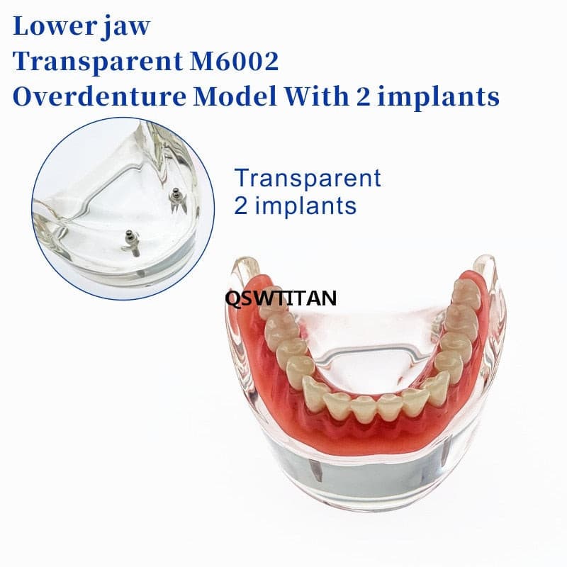 modelo prótesis dental