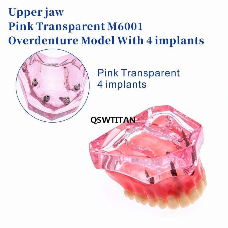 modelo prótesis dental