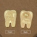 dientes de leche