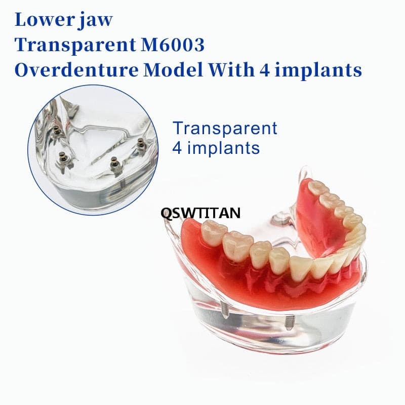 modelo prótesis dental