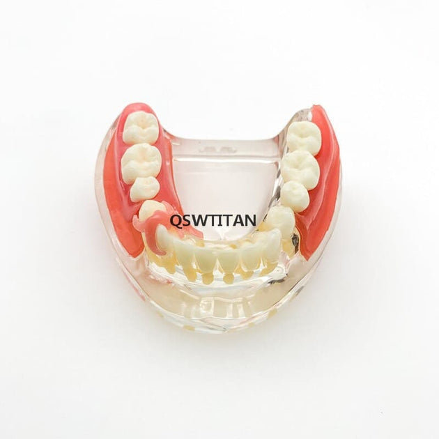 modelo didáctico implantes