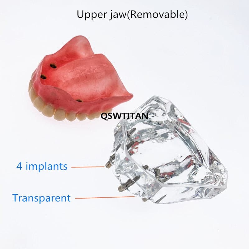 modelo prótesis dental