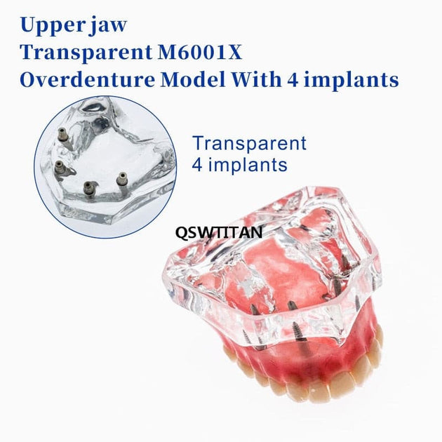 modelo prótesis dental
