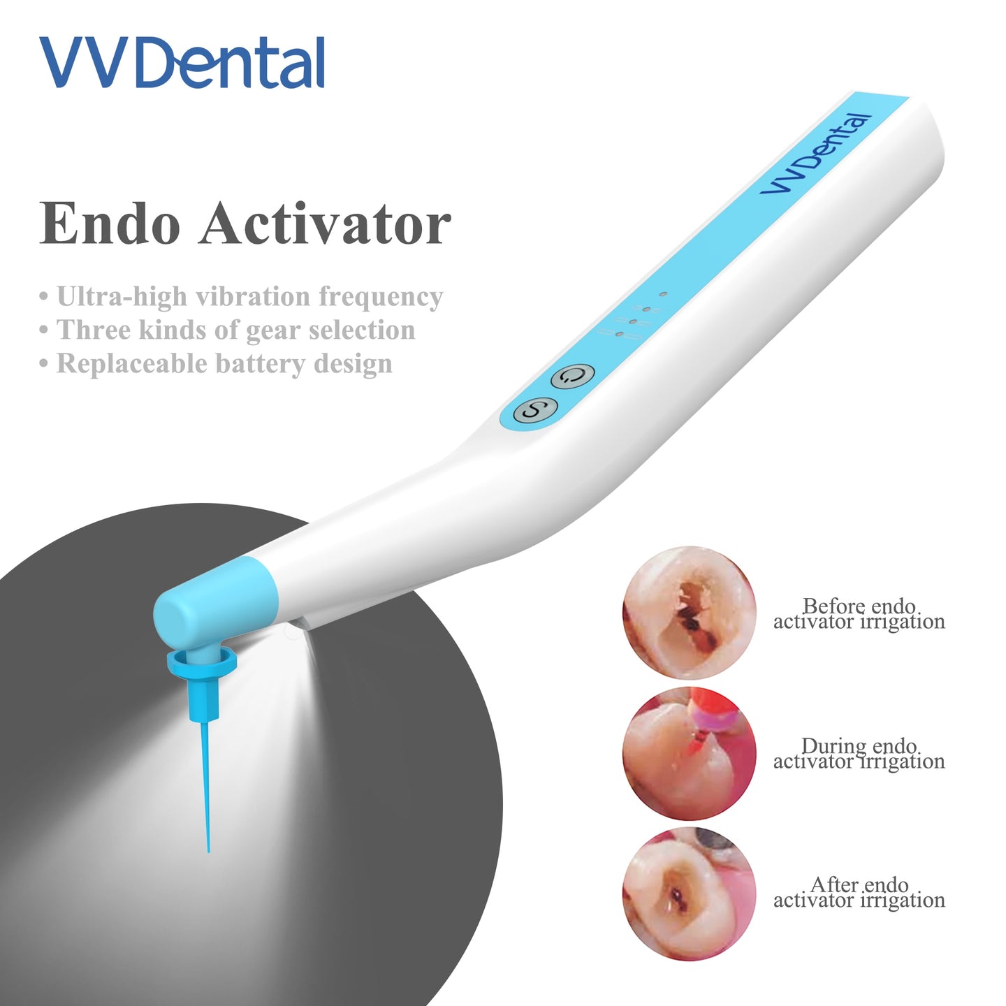 Irrigador de conducto radicular endodóntico inalámbrico para cirugía, lavadora E Irrigador de conducto radicular endodóntico inalámbrico para cirugía, lavadora E